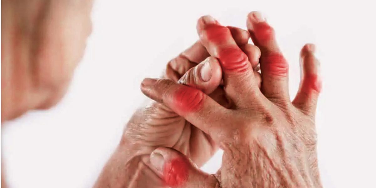 Ilustracija: Asrtritisa